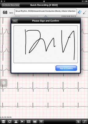 Cardiac Monitoring Equipment Handheld ECG Machine , Mobile ECG Device