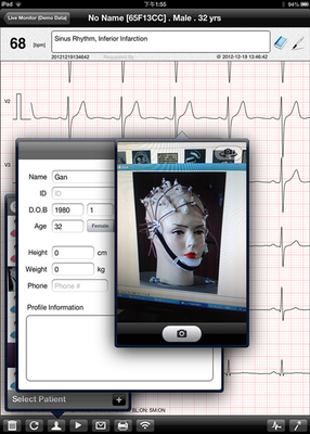 Portable Home ECG Machine 12 Lead Ambulatory ECG Monitoring With FDA