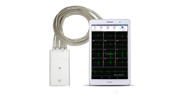 เครื่องบันทึกสัญญาณ ECG สีขาวระบบ Andriod เครื่องตรวจคลื่นไฟฟ้าหัวใจ Bluetooth